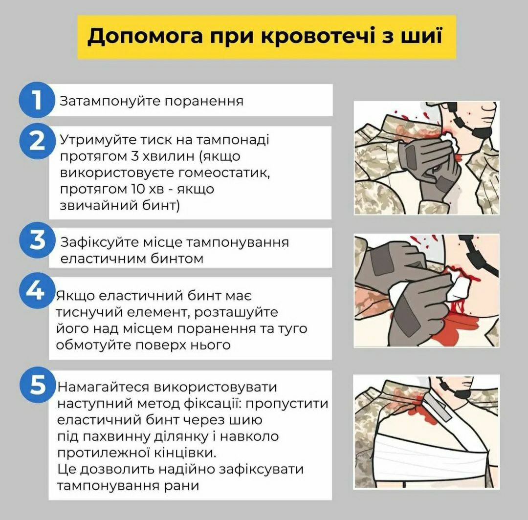 Первая медицинская помощь в экстренной ситуации: инструкции от МОЗ и ГСЧС  (видео) | РЕДПОСТ