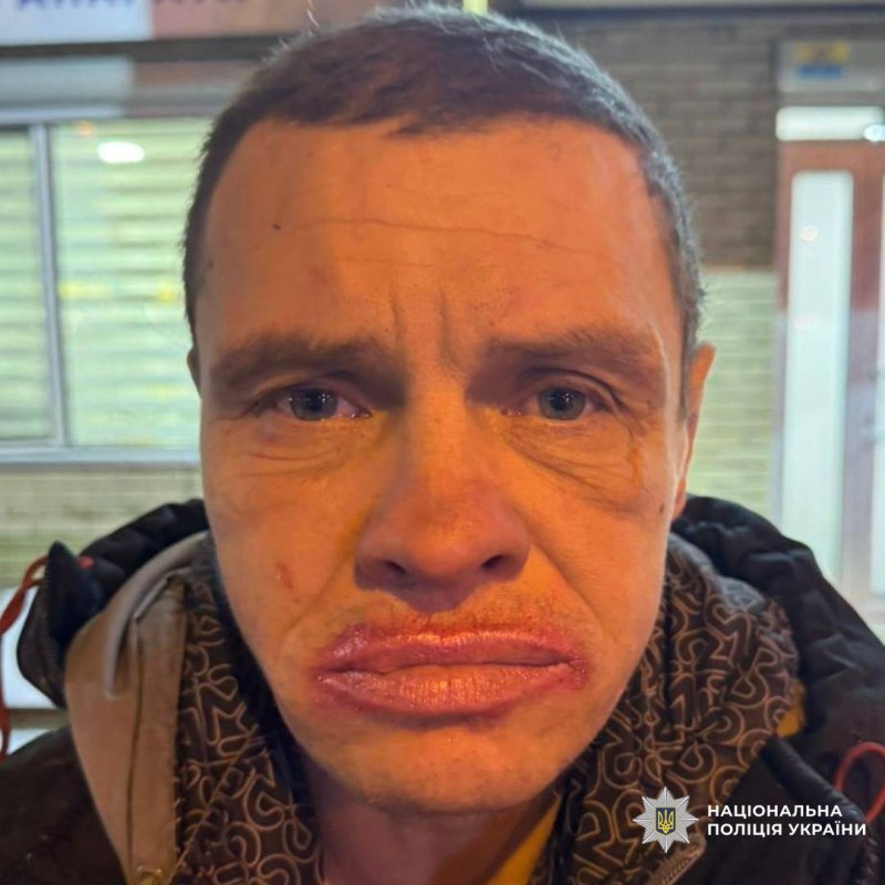 Поліція Харкова розшукує чоловіка, який напав на поліцейського