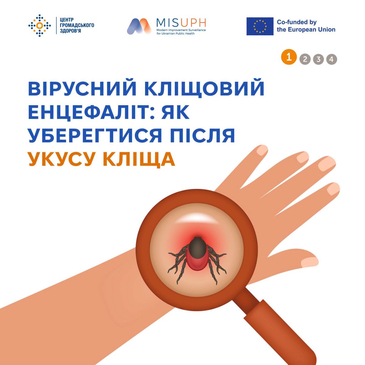 Вірусний кліщовий енцефаліт: харківські лікарі назвали прості правила захисту після укусу кліща